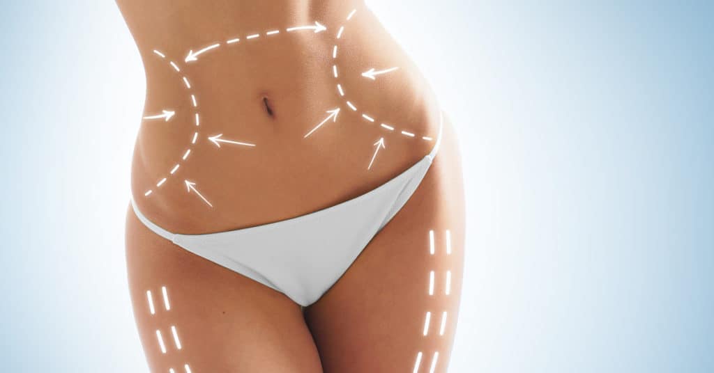 body plastic surgery procedures