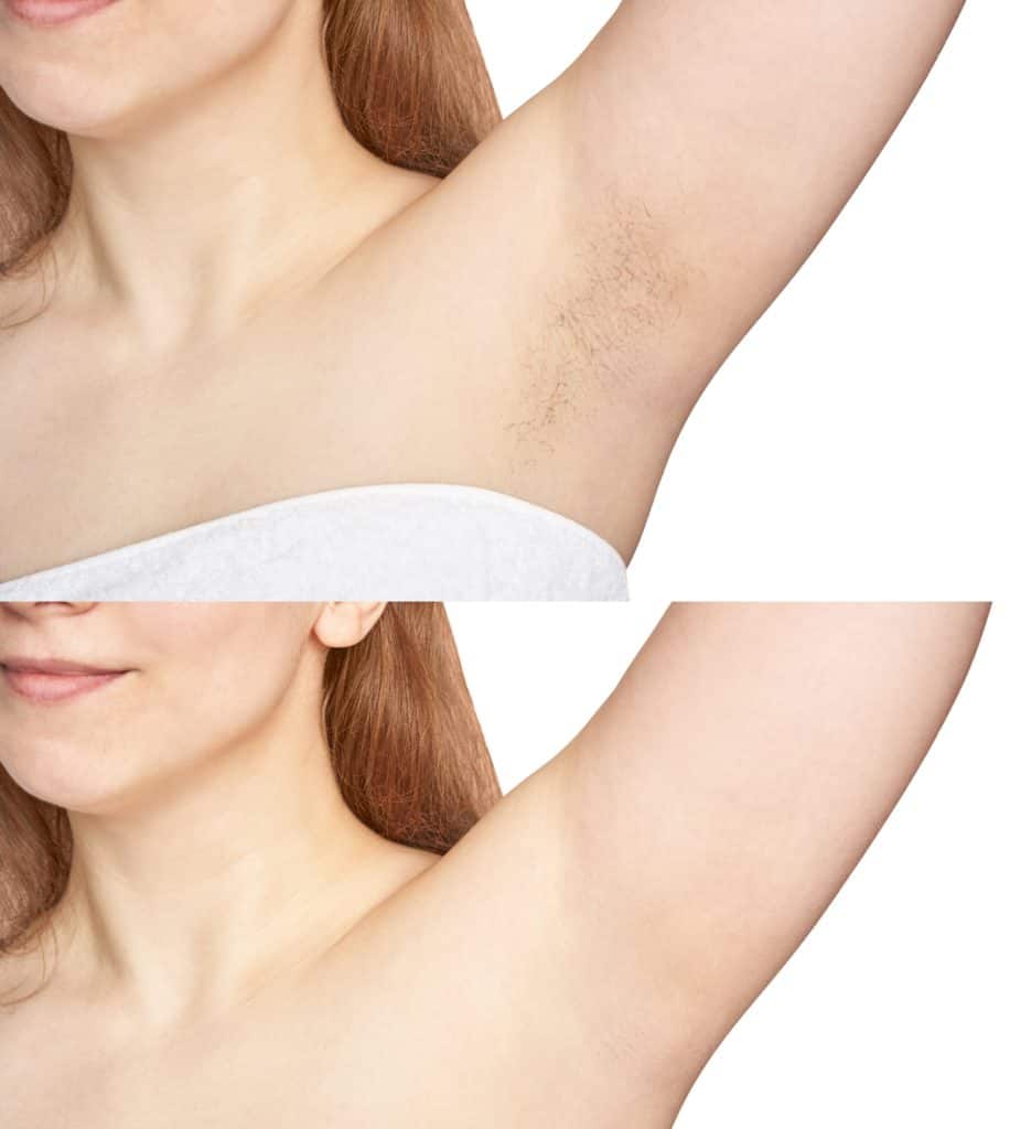 Girl underarm